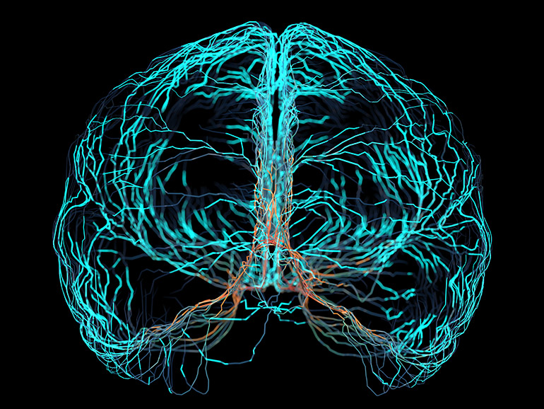 Visualization of a brain
